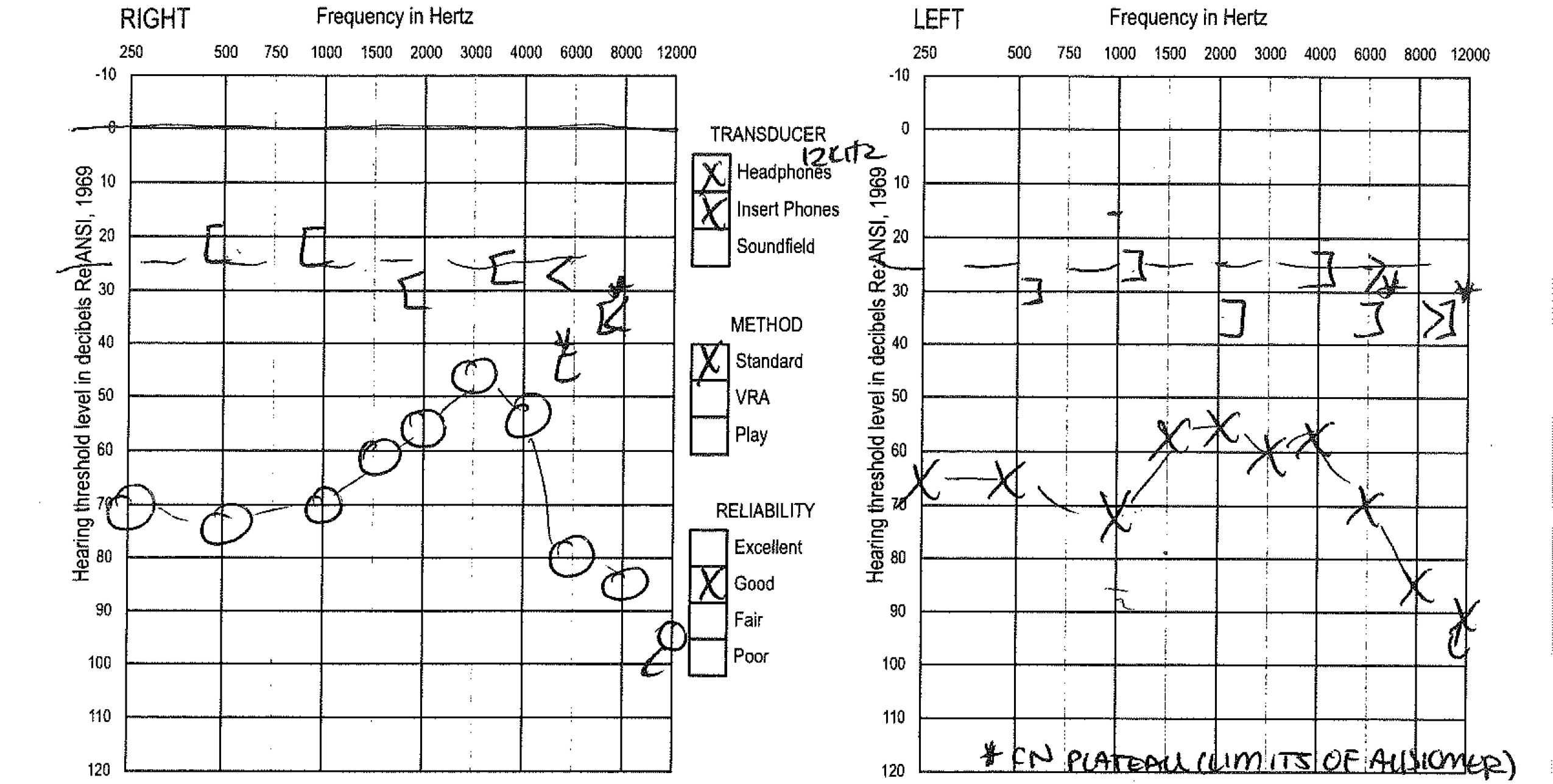 audiology20161102